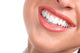 Laughing Woman Smile With Great Teeth Wall Decal