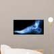 X-ray Normal Humans Foot