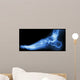 X-ray Normal Humans Foot