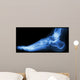 X-ray Normal Humans Foot