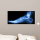 X-ray Normal Humans Foot