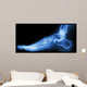 X-ray Normal Humans Foot