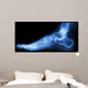 X-ray Normal Humans Foot