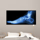 X-ray Normal Humans Foot