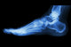 X-ray Normal Humans Foot