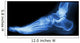 X-ray Normal Humans Foot