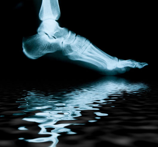 Radiograph of the foot with reflection Wall Mural