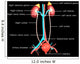 Excretory System