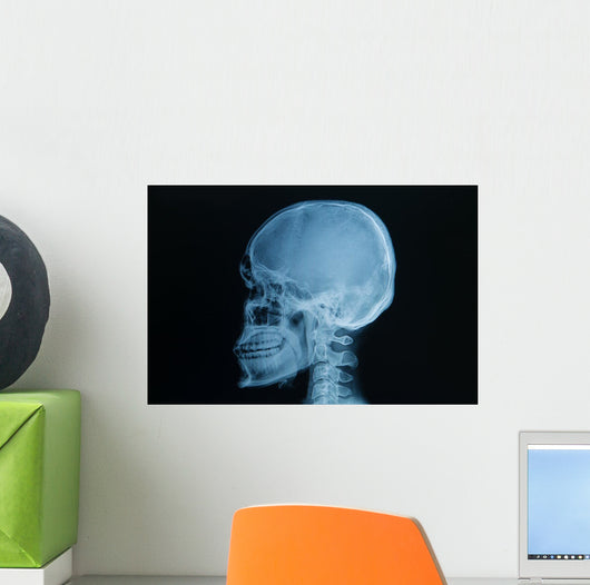 Skull X-rays Image