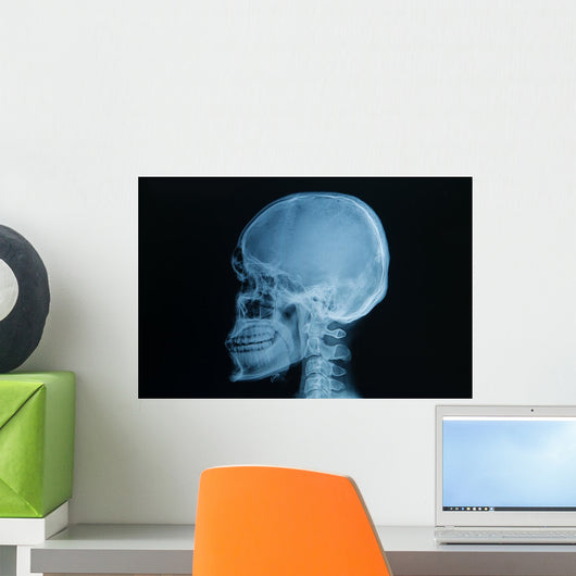 Skull X-rays Image