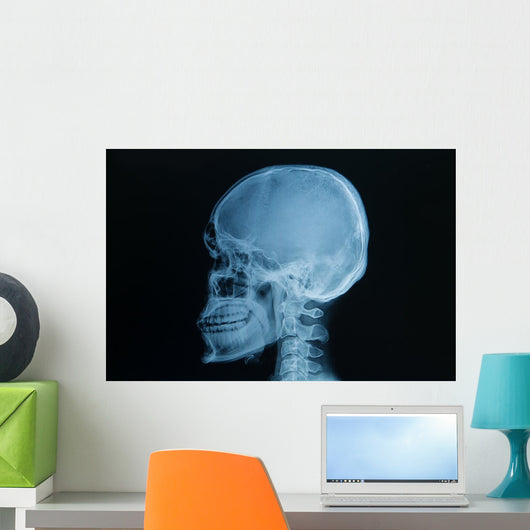 Skull X-rays Image