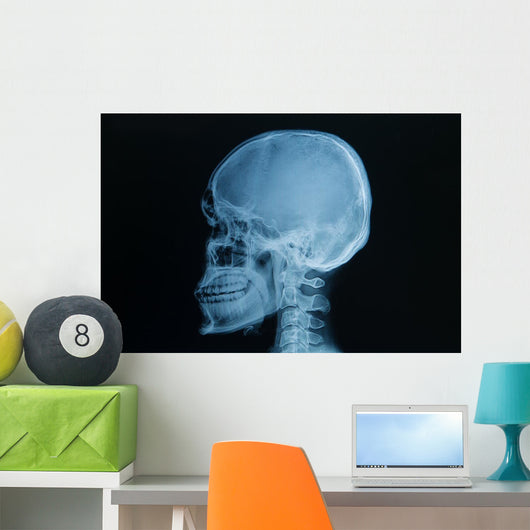 Skull X-rays Image
