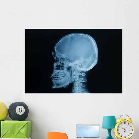 Skull X-rays Image