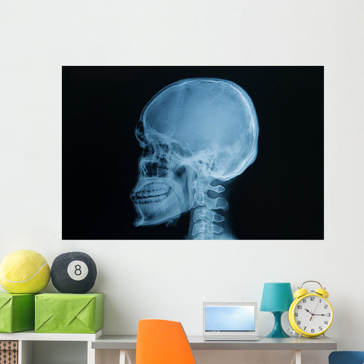 Skull X-rays Image