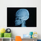 Skull X-rays Image