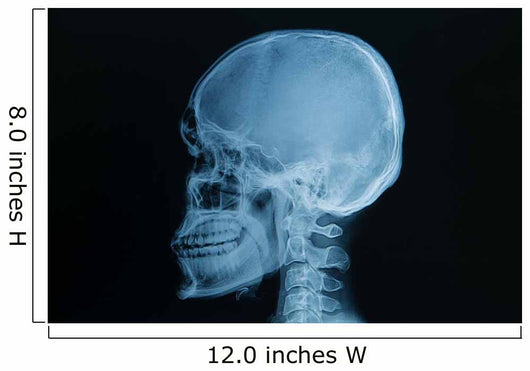 Skull X-rays Image