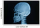 Skull X-rays Image