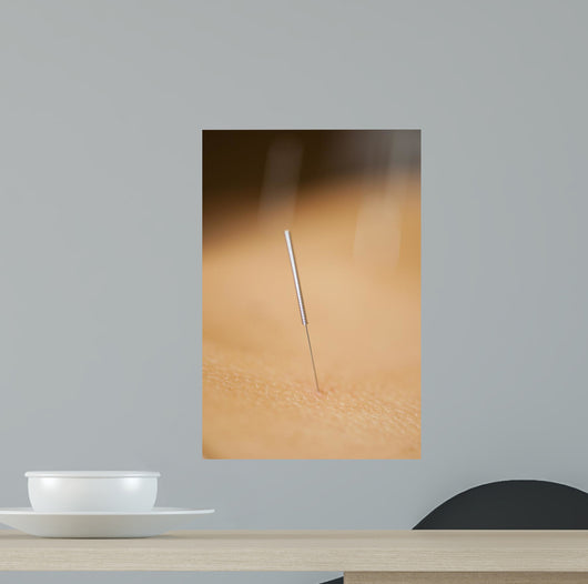 acupuncture Wall Mural