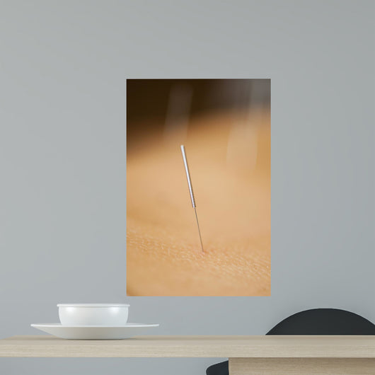 acupuncture Wall Mural