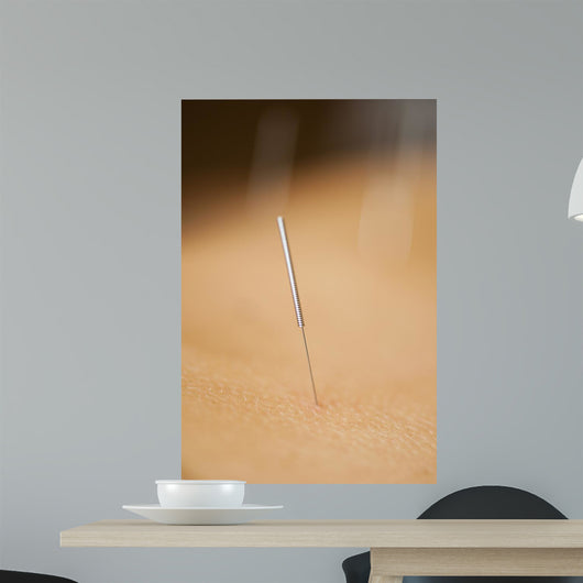 acupuncture Wall Mural