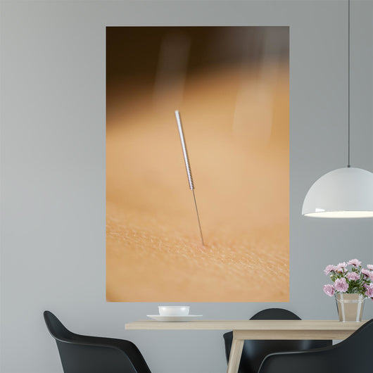 acupuncture Wall Mural