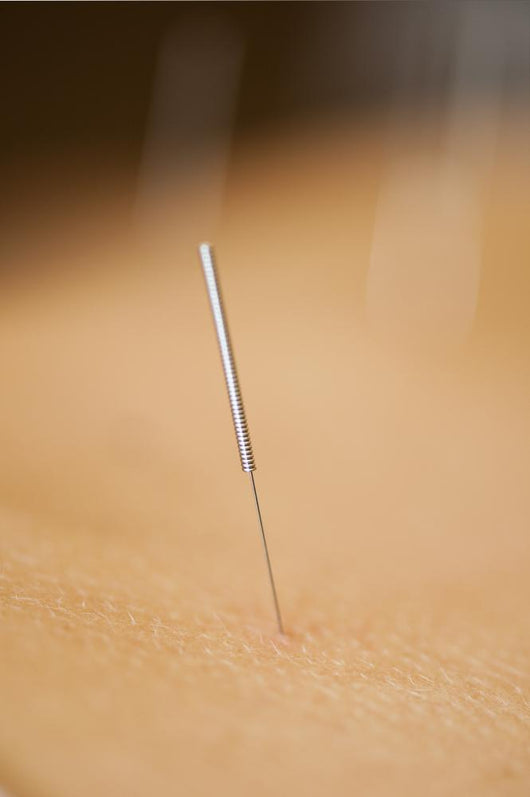 acupuncture Wall Mural