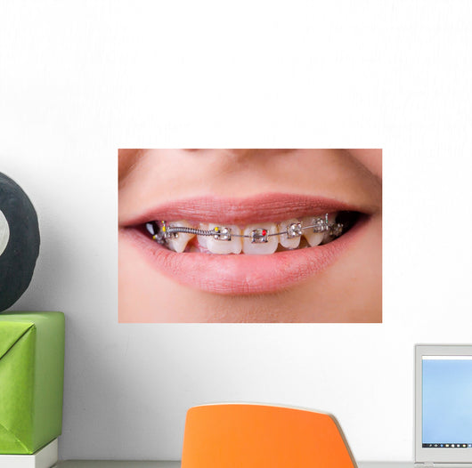 Mouth with brackets braces in medical concept Wall Mural