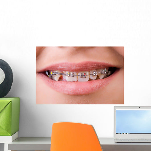 Mouth with brackets braces in medical concept Wall Mural