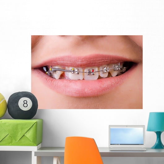 Mouth with brackets braces in medical concept Wall Mural