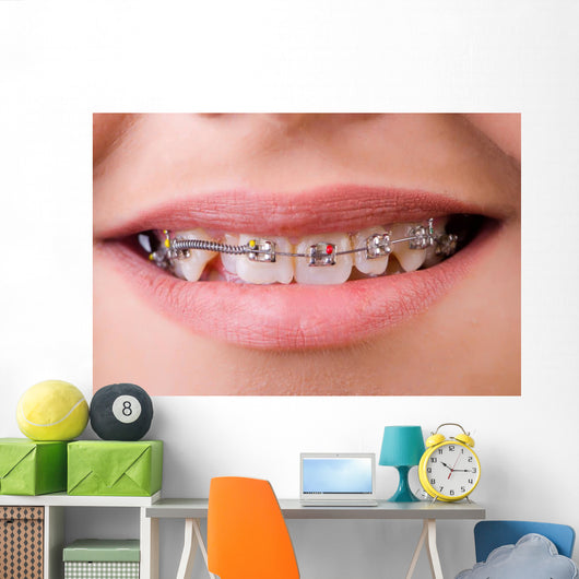 Mouth with brackets braces in medical concept Wall Mural