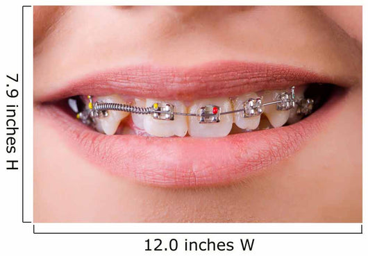 Mouth with brackets braces in medical concept Wall Mural