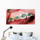 Teeth with braces Wall Mural