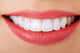 Perfect Smile Wall Decal
