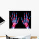 Arthritis Multiple Joint Hands Wall Decal