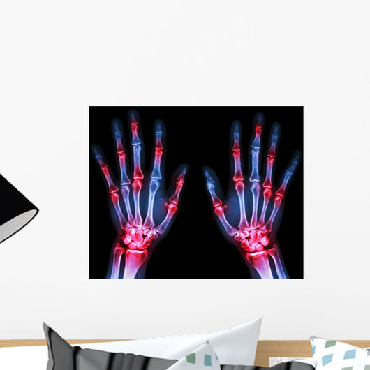 Arthritis Multiple Joint Hands Wall Decal