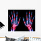 Arthritis Multiple Joint Hands Wall Decal