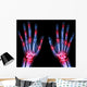 Arthritis Multiple Joint Hands Wall Decal