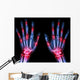 Arthritis Multiple Joint Hands Wall Decal