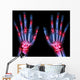 Arthritis Multiple Joint Hands Wall Decal