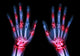 Arthritis Multiple Joint Hands Wall Decal