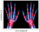Arthritis Multiple Joint Hands Wall Decal