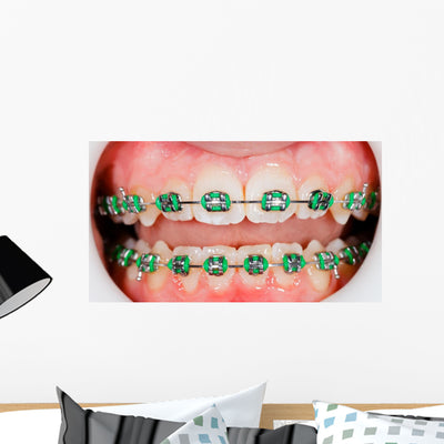 Braces On Teeth Wall Decal shown on a wall
