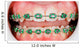 Braces on teeth Wall Mural