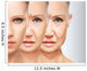 Beauty Concept Skin Aging Wall Decal