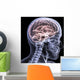 Skeleton X-Ray - Brain 1 Wall Mural