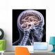 Skeleton X-Ray - Brain 1 Wall Mural