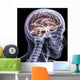 Skeleton X-Ray - Brain 1 Wall Mural