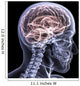 Skeleton X-Ray - Brain 1 Wall Mural