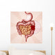 colon cancer Wall Mural