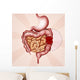 colon cancer Wall Mural